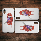 Lollipop Lips Phone Case